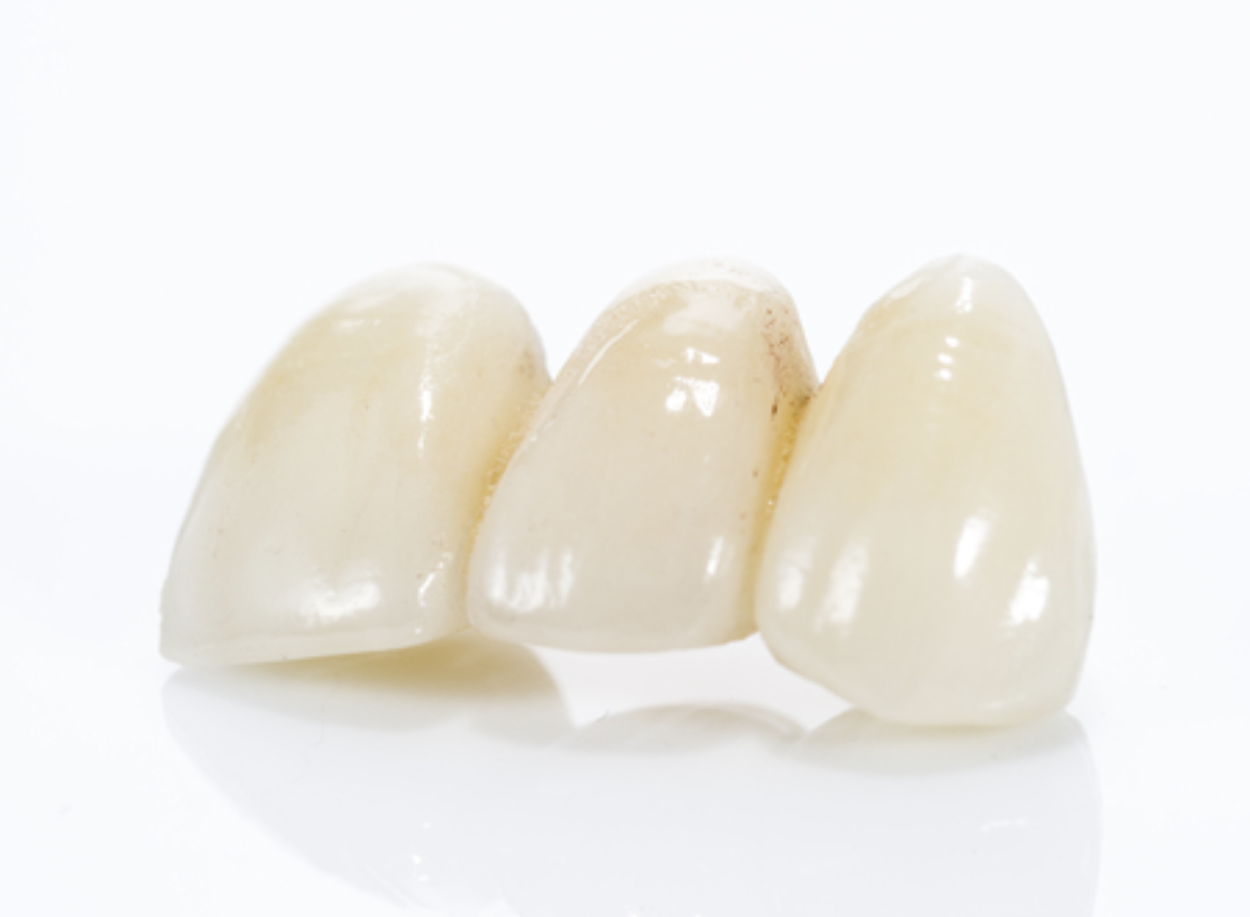 dental crowns in menorca